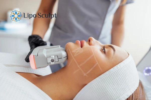 HIFU vs Botulinum Toxin: Understanding the Differences 1 HIFU vs Botox Essex What is the best option for you?