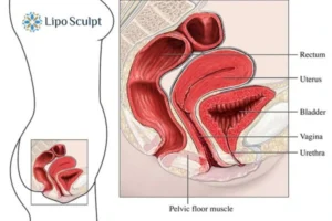 Treatment For A Leaky Bladder 2 How EM Chair treatment Essex can help Leaky bladder issues. Read more now!