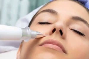 Best Actinic Keratoses Removal 3 Actinic keratoses Essex solutions - book in today!