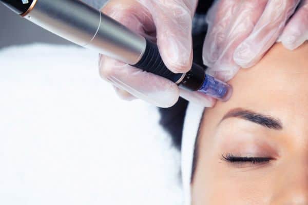 Explaining Total Skin Tightening Treatment and What to Expect 2 What Skin Concerns Can Total Skin Tightening Treatment Help With Essex?